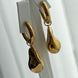 ARETE IRREGULAR