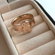 ANILLO OSITO